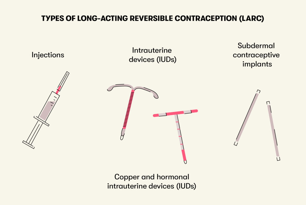 Larc All You Need To Know About Long Acting Reversible Contraception 